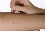 skin prick test