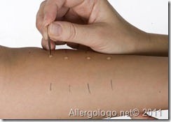 Prick Test: fase 2