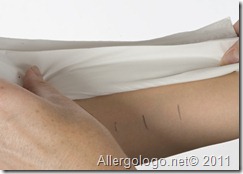Prick Test: fase 3