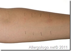 Prick Test: fase 4