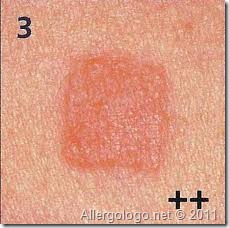 patch test patch test 2