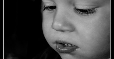 allergia alimentare nei bambini