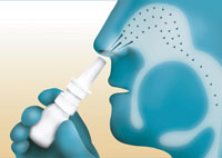 Immagine stilizzata di una persona che si spruzza lo spray nasale per la rinite allergica
