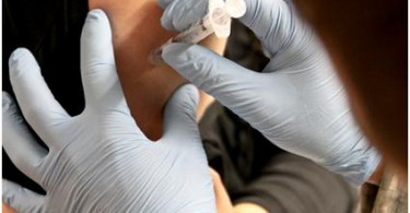 immunoterapia o vaccino anti-allergico