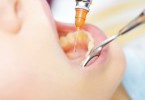 Allergie dal dentista