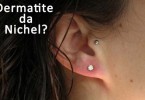 Dermatite da nichel