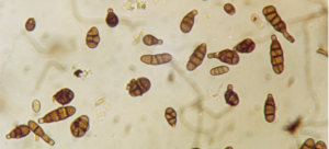 allergia alternaria