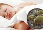 allergia agli acari