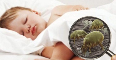 allergia agli acari